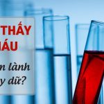 Nằm mơ thấy máu mang điềm báo gì? Ý nghĩa trong từng con số?
