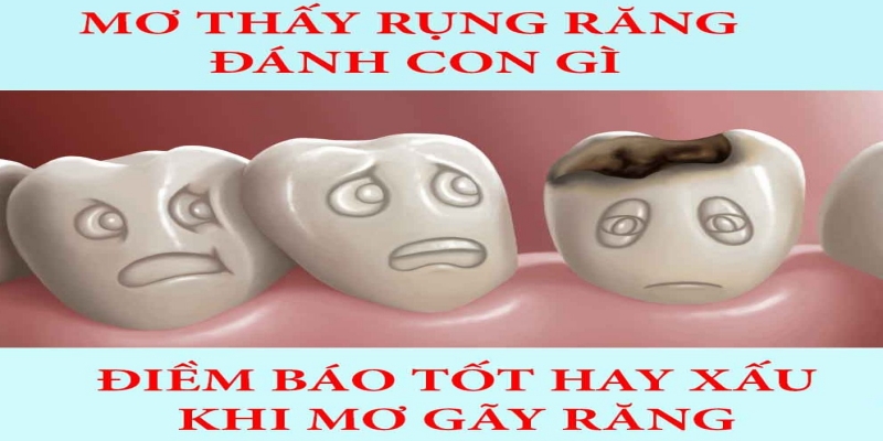 Ý nghĩa nằm mơ thấy nhổ răng hàm dưới